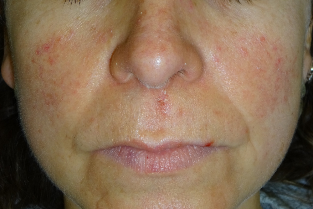 Dermatologia Pamplona (1)