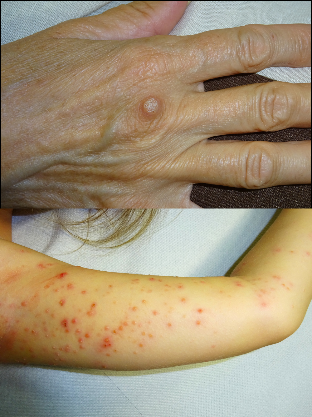 Dermatologia Pamplona (2)