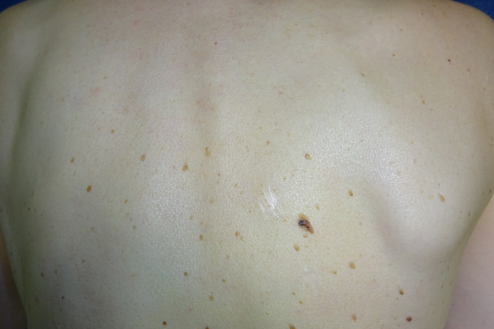 Dermatologia Pamplona (3)