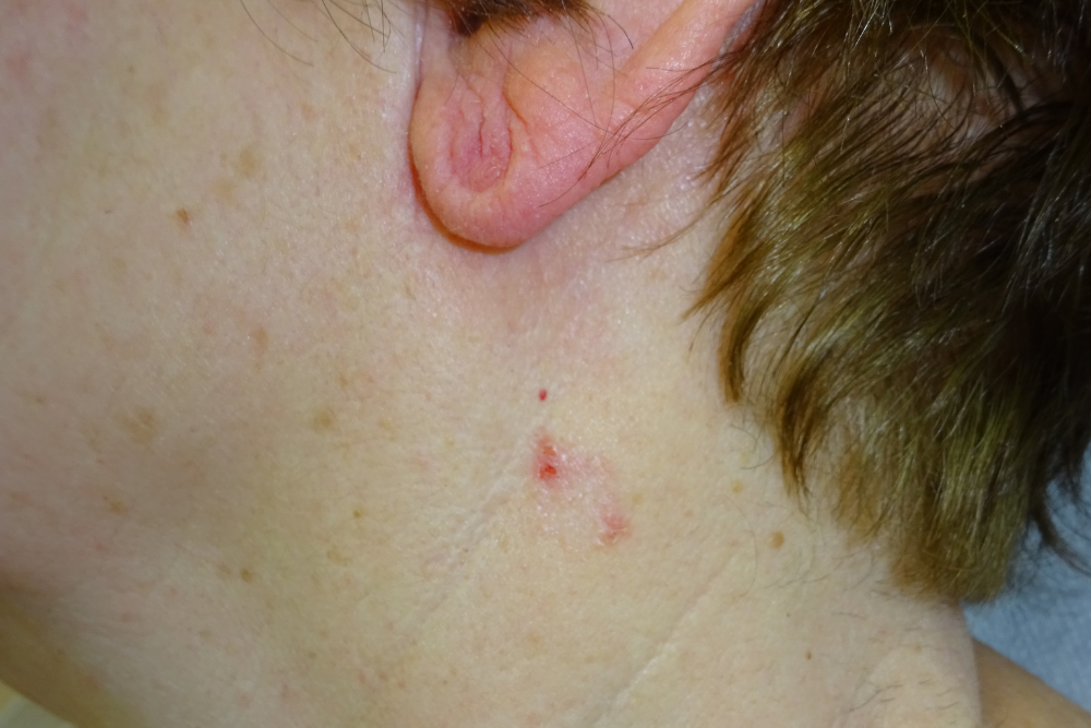 Dermatologia Pamplona (4)