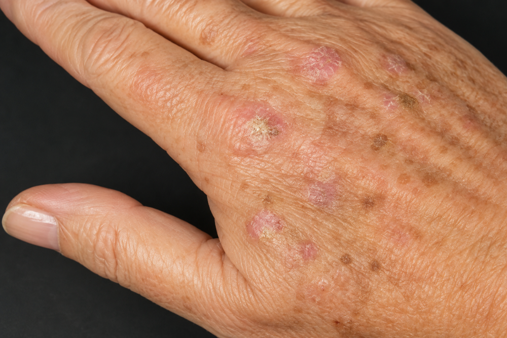 Dermatologia Pamplona (5)