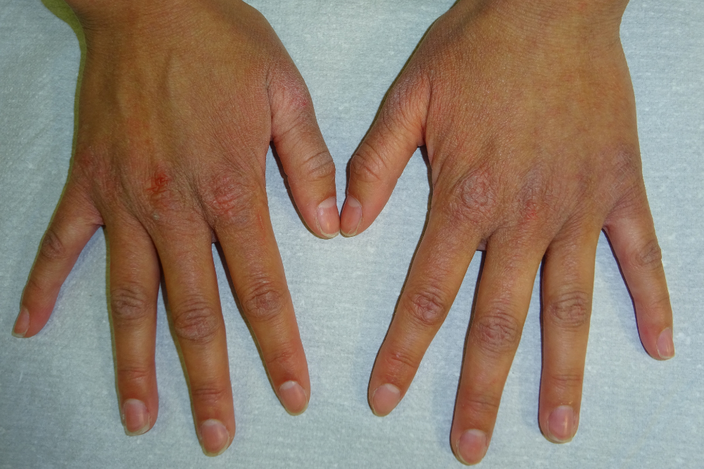 Dermatologia Pamplona
